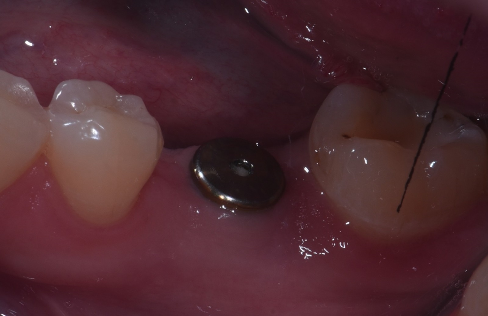 Фото клиники Smile Центр